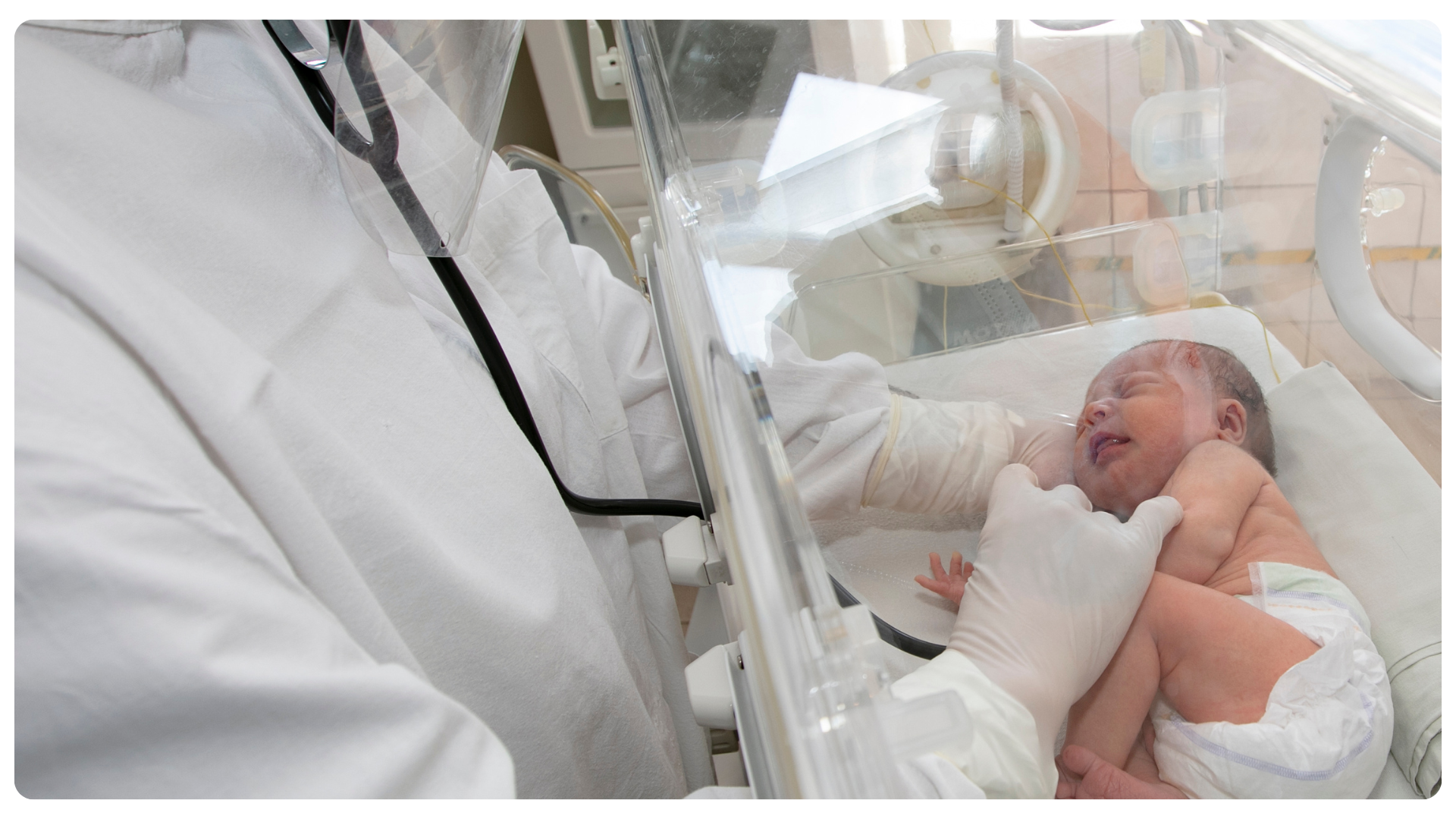 Seguimento de Prematuros