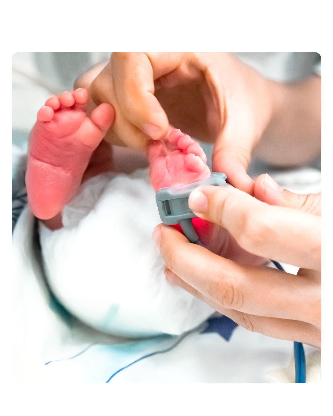 Bebês prematuros